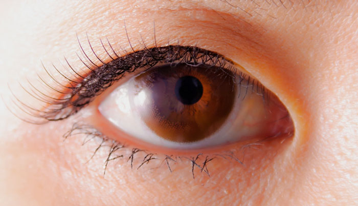 眼球イメージ